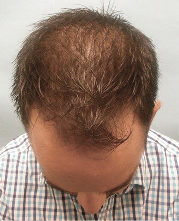 Before