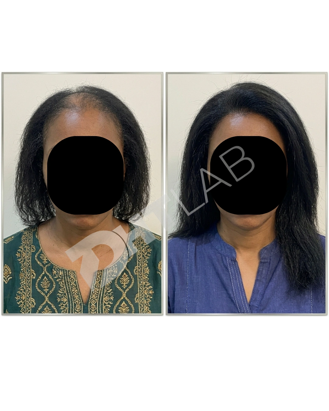 AnyToolz_compressed_FINAL VIDEO BEFOREAFTER AD (1)