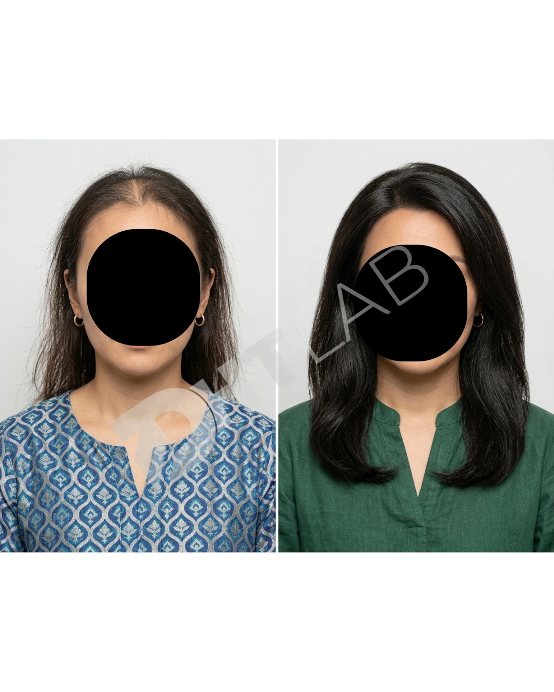 AnyToolz_compressed_FINAL VIDEO BEFOREAFTER AD