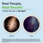 DHTLAB™ Science-Backed Multi-Peptide DHT Blocker & Hair Growth Serum - Image 10