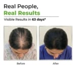 DHTLAB™ Science-Backed Multi-Peptide DHT Blocker & Hair Growth Serum - Image 11