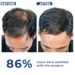 DHTLAB™ Science-Backed Multi-Peptide DHT Blocker & Hair Growth Serum - Image 12