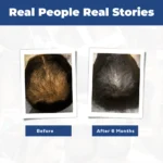 DHTLAB™ Science-Backed Multi-Peptide DHT Blocker & Hair Growth Serum - Image 9