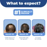 DHTLAB™ Science-Backed Multi-Peptide DHT Blocker & Hair Growth Serum - Image 13
