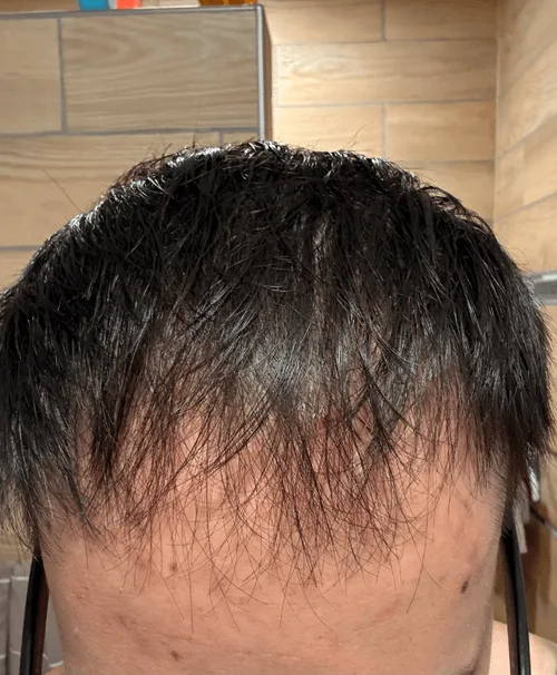 Before