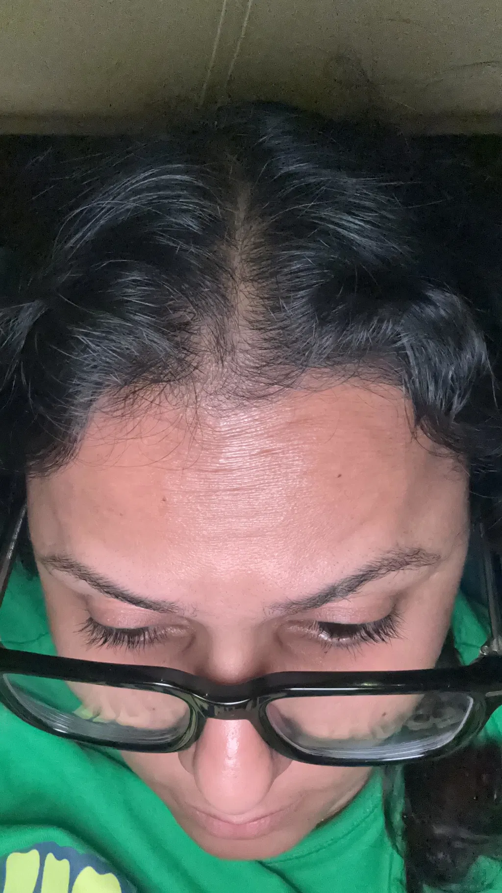 Before