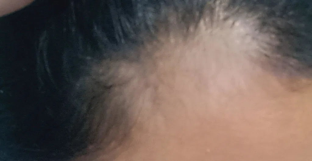 After