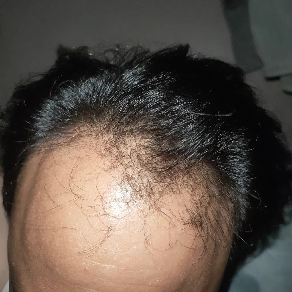 Before