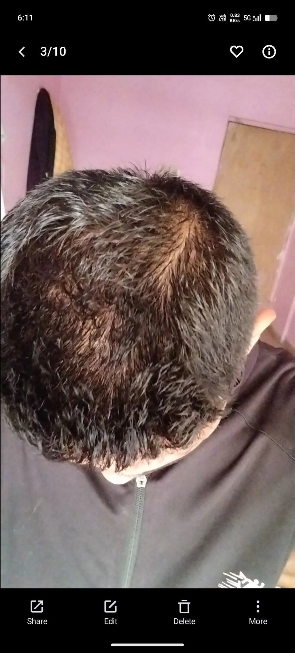 Before