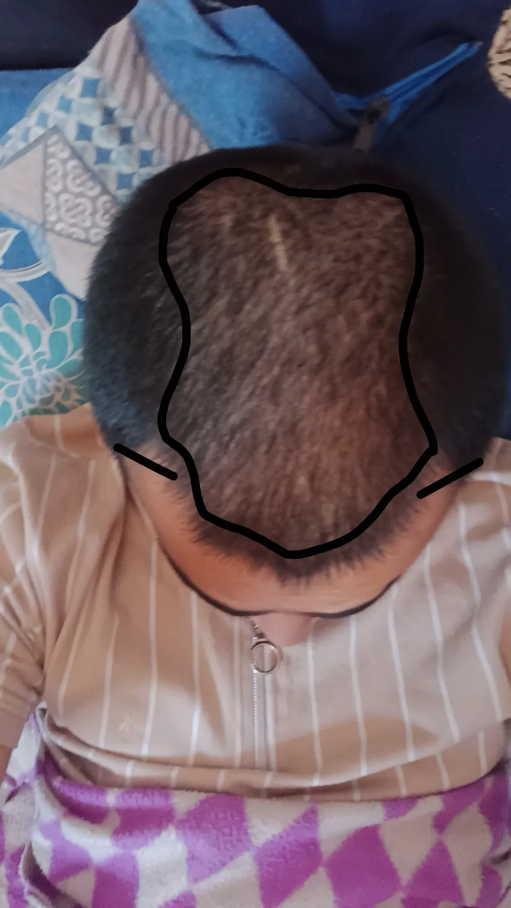 After