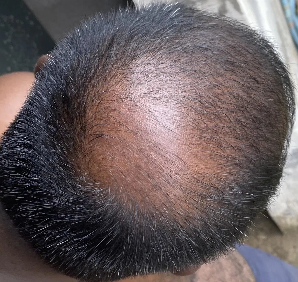 After