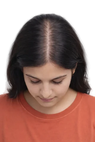 Stage 2