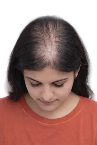 Stage 6