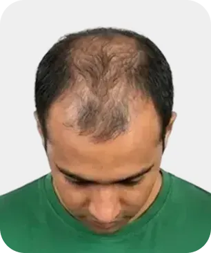 Stage 5