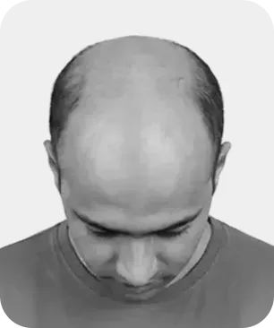 Stage 7